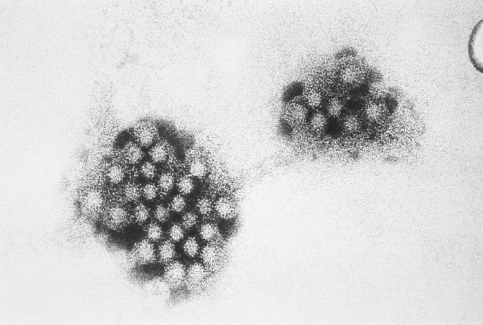 File:Norovirus EM PHIL 2172 lores.jpg