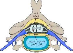 موقع الخلايا العصبية المتضررة من ضمور العضلات الشوكي في النخاع الشوكي