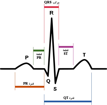رسم توضيحي لنظم جيبي طبيعي لدى قلب إنساني كما يظهر في مخطط كهربية القلب (موسومة باللغة العربية)