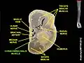 Coracobrachialis muscle (shown in green text. مستوى مستعرض of arm.