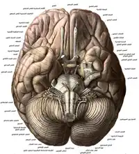 دماغ معروض من الأسفل. هذا مثال على مستوى عرضي.