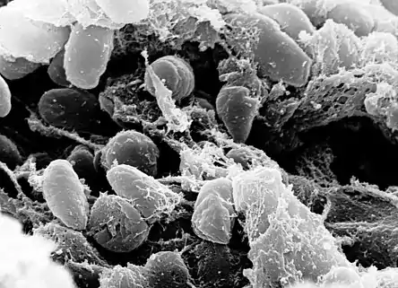 صورة اليرسينية الطاعونية Yersinia pestis باستخدام تقنية المجهر الالكتروني