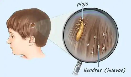 Estrema ente pioyos y bibes