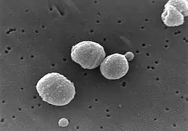 Streptococcus pneumoniae — часты ўзбуджальнік пнеўманіі.