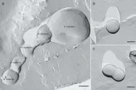 EM-Aufnahmen von Ca. S. hospitalis und Ca. M. harzensis.