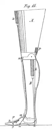 Beinprothese mit mechanischem Kniegelenk nach Caroline Eichler (1834)