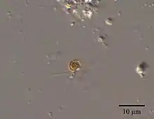 Chrysochromulina parva vom Süßwasser des Skinnerflo-Sees (Ostfold, Norwegen) entnommen am 27. Juli 2013Birger Skjelbred (NIVA) via SMHI