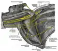 Der rechte Plexus brachialis (der infraclaviculäre Anteil), Sicht von vorn unten