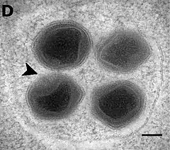 Neu gebildete BsV-Virionen im Inneren eines Vesikels. Am Apex des linken un­teren Virions befindet sich ein geschlossenes Stargate (schwarze Pfeilspitze).