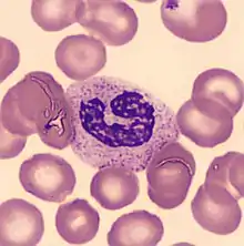 Stabkerniger neutrophiler Granulozyt