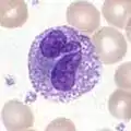 Eosinophiler Granulozyt