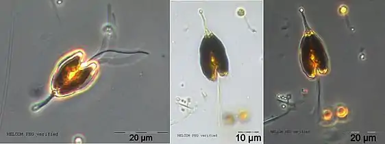 P. longicauda, Phasen­kontrast­mikro­skopie (PCM).Susanne Busch, via SMHI