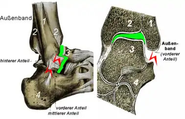 Instabilität des Außenbandapparates Links: Das Sprungbein lässt sich nach vorne ziehen.Rechts: Das obere Sprunggelenk ist seitlich aufklappbar.(1 Wadenbein, 2 Schienbein, 3 Sprungbein und 4 Fersenbein).
