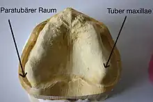 Paratubärer Raum