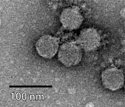 Clostridium-Phage CPS2, Guelinviridae