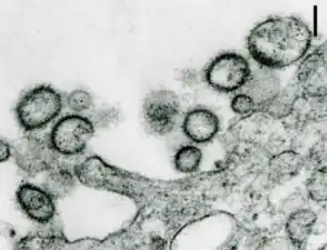 „Aransas-Bay-Virus“