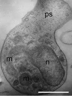 Amoeboaphelidium protococcarum