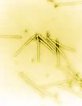 Electron micrograph of rod shaped TMV particles.