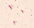 Bacillus cereus