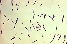 Clostridium perfringens