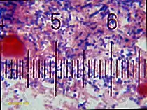 Plakin baktereja mikroskooppikuvassa. Kuvan numeroidut viivat ovat 10 µm etäisyydellä toisistaan.