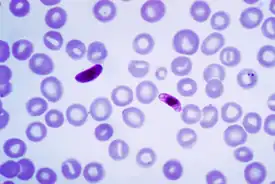 Plasmodium falciparum veren sivelyvalmisteessa