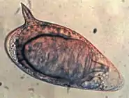 Schistosoma mansoni