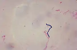 Streptococcus-bakteereita.