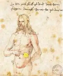 Dr Albrecht Dürer wyst uf syni Malaria-Symptom aane.